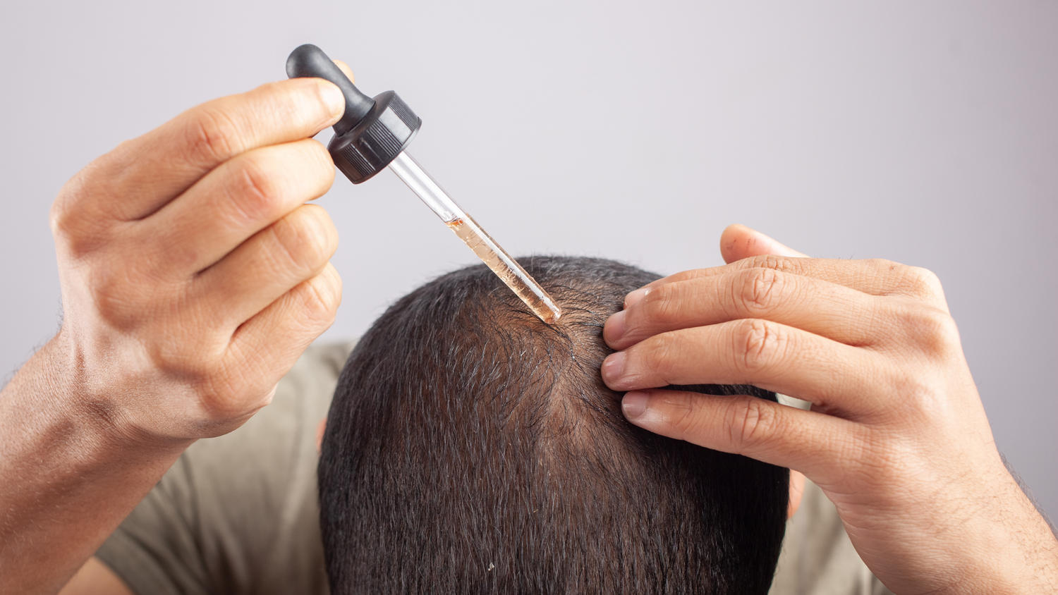Easy Guide How To Apply Minoxidil Foam For Hair Growth Dr Yates MD easy-guide-how-to-apply-minoxidil-foam-for-hair-growth-dr-yates-md